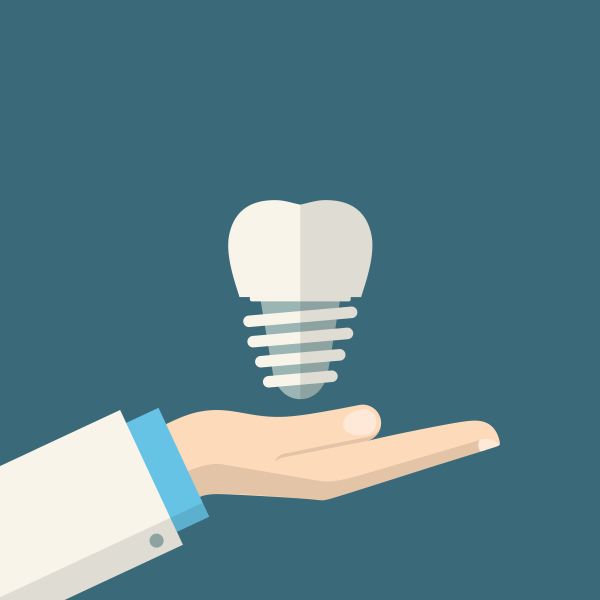 How Dental Implants Improve Your Jawbone