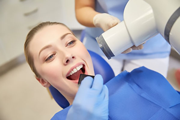 dental sealants El Monte, CA