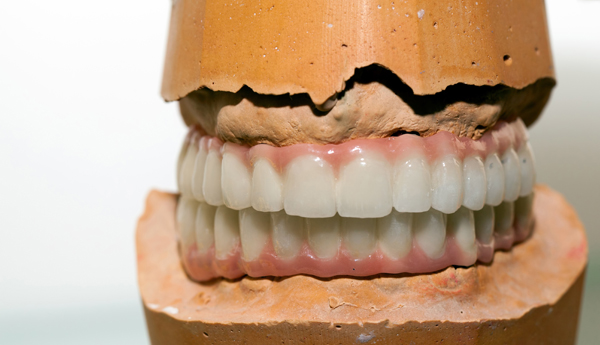 How Often Should Dentures Be Relined?
