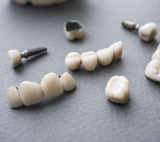 El Monte The Difference Between Dental Implants and Mini Dental Implants