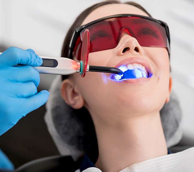 El Monte Professional Teeth Whitening